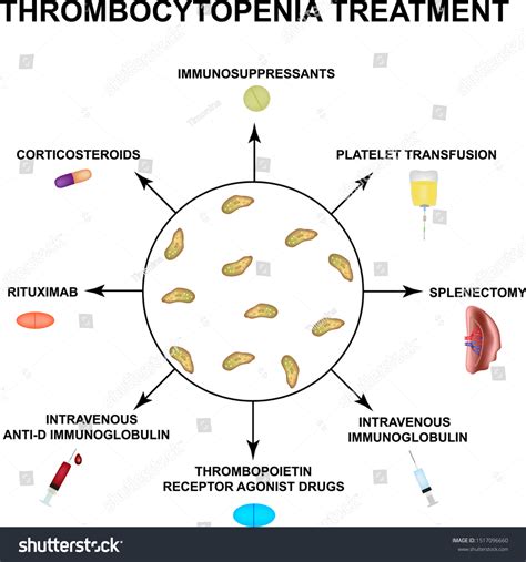 Thrombocytopenia Treatment Lowering Platelets Blood Infographics Stock ...