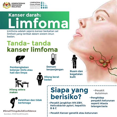 Apa Itu Kanser Limfoma - malaowesx