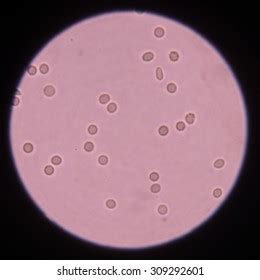 Red Blood Cells Urine Specimen Under Foto de stock 309292601 | Shutterstock