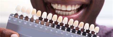 What the color of your teeth says about you - Delta Dental