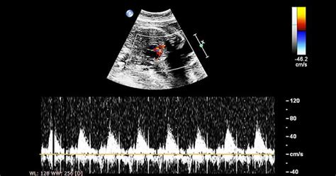 Ecocardiograma fetal, ¿qué es y cuándo es necesario?