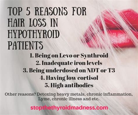 Best Treatment For Hair Loss Due To Thyroid - The 2023 Guide to the ...