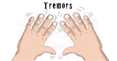 Tremor Causes, Symptoms, Diagnosis and Treatment - Natural Health News