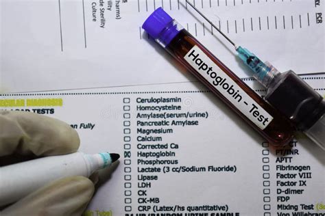 Haptoglobin - Test With Blood Sample. Top View Isolated On Office Desk. Healthcare/Medical ...