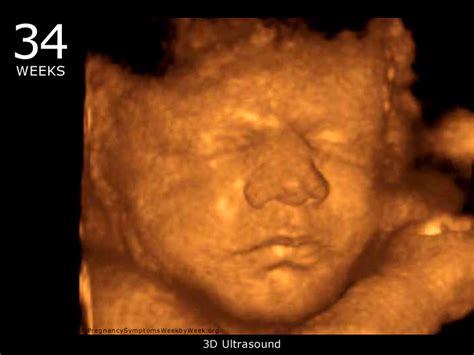 3d Ultrasound Pregnancy :: 3d Puzzle Image