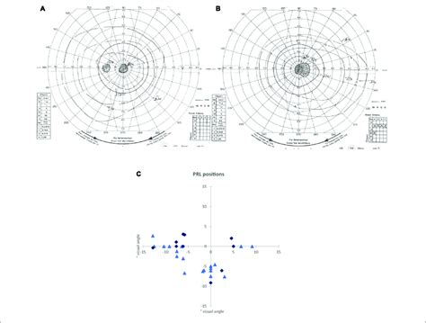 | (A,B) Examples of visual field measurements using Goldmann perimetry:... | Download Scientific ...