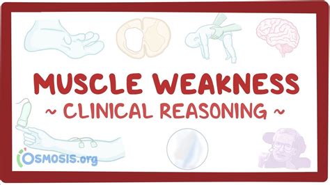 Muscle weakness: Clinical: Video, Causes, & Meaning | Osmosis