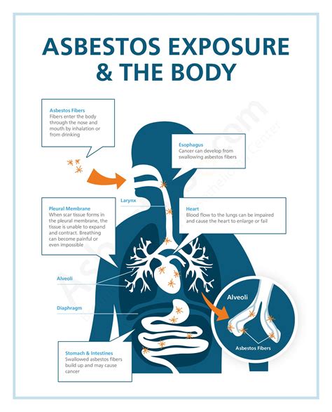 Asbestos Can Cause Which of the Following Diseases