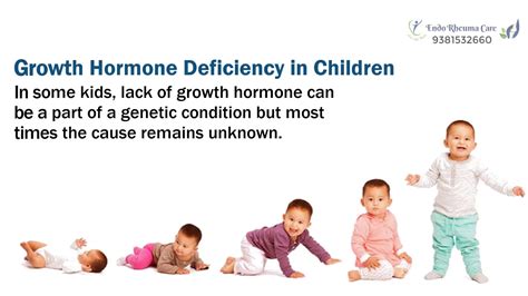 Growth Hormone Deficiency in Adults and Children | Endorheuma Care Hyderabad - YouTube