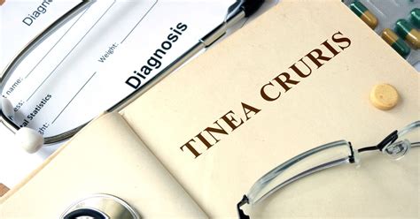 Symptoms and Treatments of Tinea Cruris - Facty Health