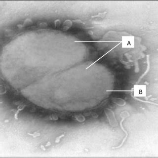 Neisseria meningitidis morphology under an electron microscope. A. The... | Download Scientific ...