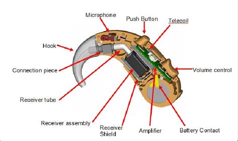 Hearing Aid Diagram