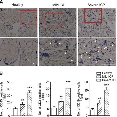 Immune cell infiltration in placental tissues from healthy group, mild ...