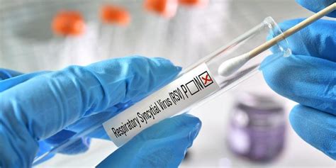 Benefits of RSV Antigen Test Kits - DrugTestKitUSA