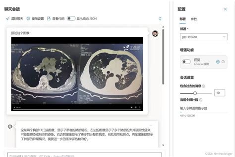 gpt-4-vision-preview-azure上可以用啦-CSDN博客