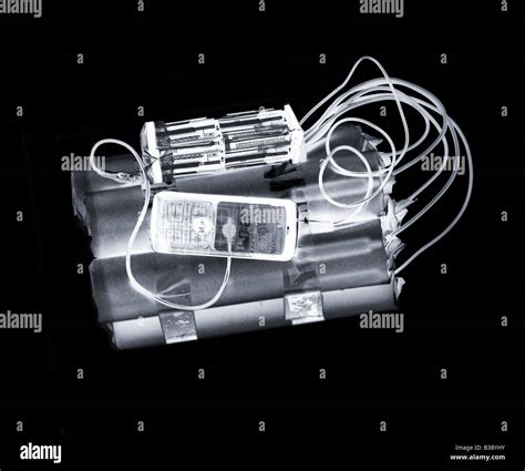 X-ray of a bomb Stock Photo, Royalty Free Image: 19317479 - Alamy