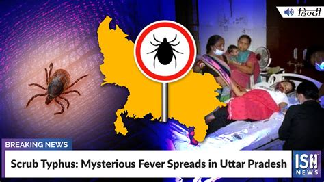 Scrub Typhus: Mysterious Fever Spreads in Uttar Pradesh - YouTube