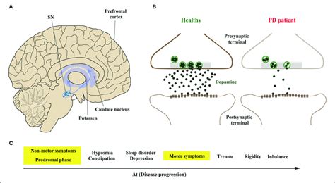 Parkinson's Disease Dopaminergic Neurons - Captions Update Trendy