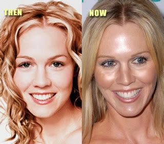 Jennie Garth Plastic Surgery Before and After Eyelid,Botox and Facelift ...