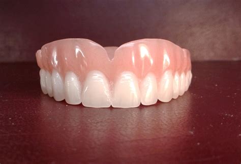 Denture upper false teeth by denturestore on Etsy