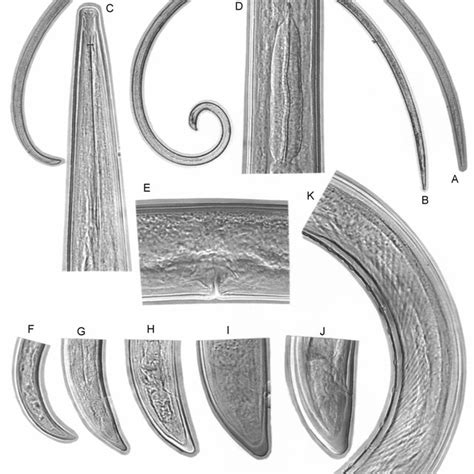 Longidorus elongatus (de Man, 1876) Micoletzky, 1922. A-Entire female;... | Download Scientific ...