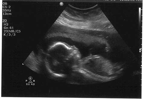 The Starr Family Blog: Baby Boy Ultrasound