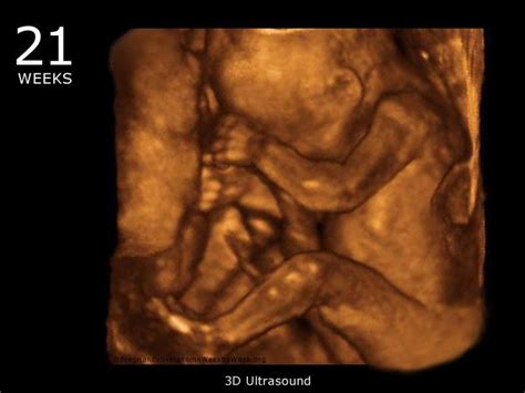 3D Ultrasound at 21 weeks pregnant: By the 21st week of pregnancy, baby fat has started to cover ...