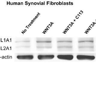 Wnt inhibitor treatment results in decreased collagen type I ...