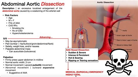 Abdominal Aortic Aneurysm (AAA) | Presentation, Risk Factors, & Signs/Symptoms - YouTube