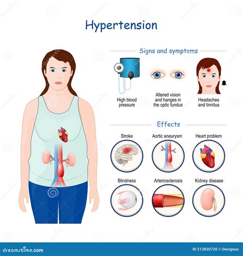 Hypertension. Signs, Symptoms, and Effects of High Blood Pressure Stock Illustration ...