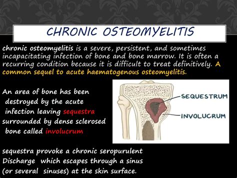 Pathophysiology Of Osteomyelitis Epomedicine | The Best Porn Website