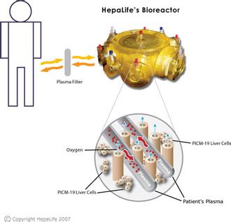 health and medicare: Bio-artificial liver device