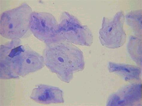 Cheek Cells 100x