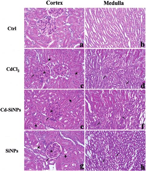 Micrographs showing representative sections of kidney parenchyma... | Download Scientific Diagram