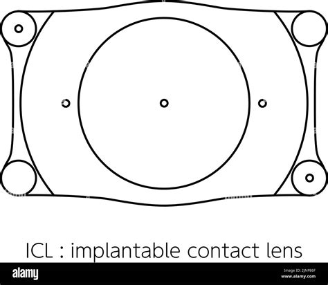 ICL, intraocular contact lens illustration Stock Vector Image & Art - Alamy