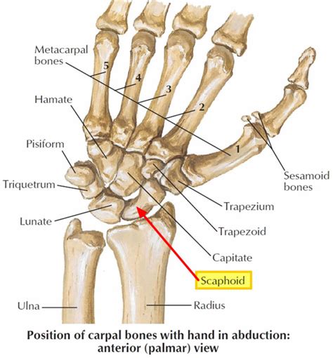 Scaphoid fracture causes, symptoms, diagnosis, treatment & revovery time