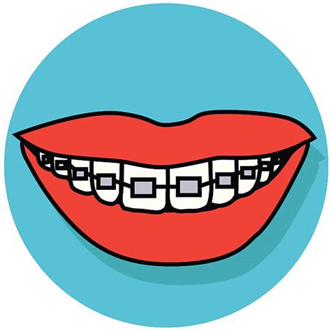 Royalty Free Braces Clip Art, Vector Images & Illustrations - iStock