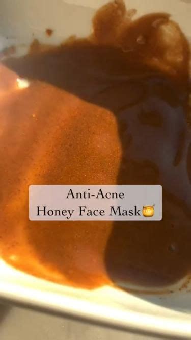 Anti Acne Honey Face Mask | Honey face mask, Acne face mask, Homemade skin care