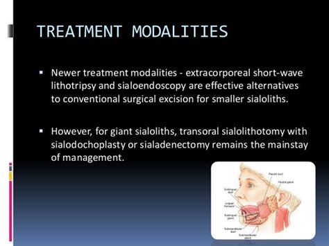 Sialolithiasis and its management in oral and maxillofacial surgery