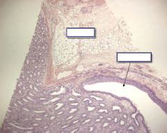 Histology - Renal Foreign Language Flashcards - Cram.com