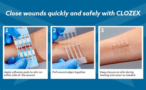 FDA Cleared Clozex Emergency Laceration Closures - Repair Wounds without Stitches - 3 Closures ...