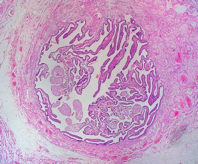 Oviduct Histology - Oviduct - histology slide