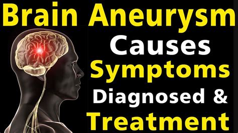 Brain Aneurysm - Causes, Symptoms, Warning Signs, Treatment