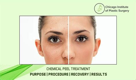 Chemical Peel Treatment: Purpose, Procedure, Recovery, Results, Types ...