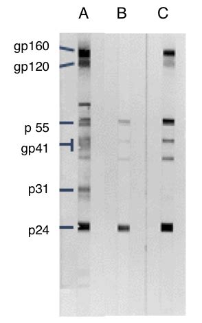 Principle of western blot test - klopeast