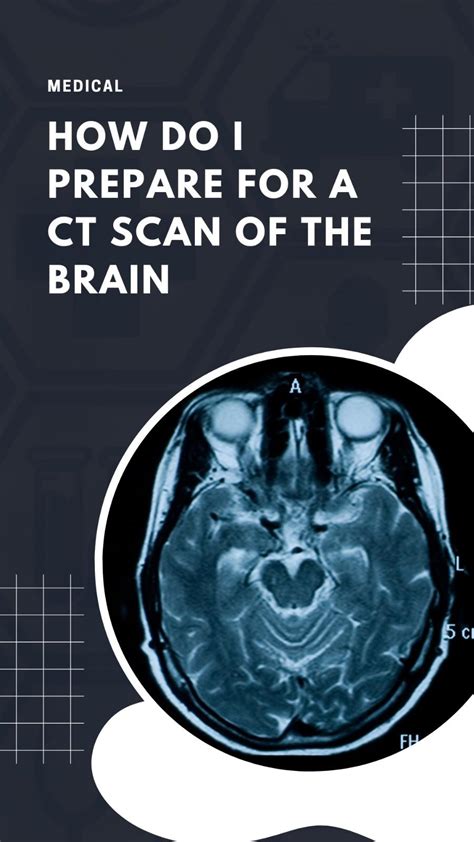 CT Scan Brain APK for Android Download