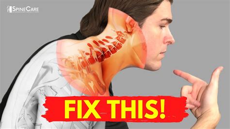 Best Ways to Get Neck Bulging Disc Pain Relief AT HOME - YouTube