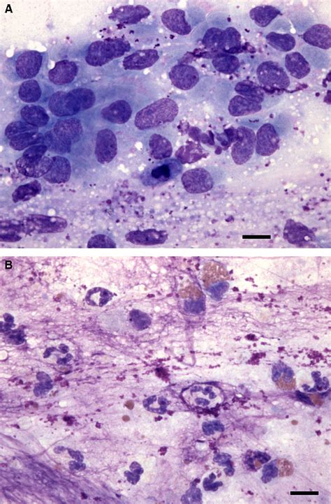 Figure 1 from Tracheobronchial Brush Cytology and Bronchoalveolar Lavage in Dogs and Cats with ...