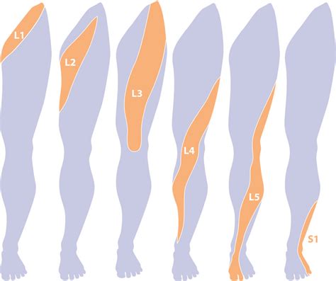 Znalezione obrazy dla zapytania l4 dermatom | Physical therapy, Massage therapy, Medical anatomy