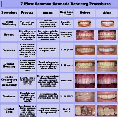 Most Common Cosmetic Dentistry Procedures | Cosmetic dentistry, Cosmetic dentistry procedures ...